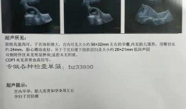 怀胎在线观看,揭秘孕期生活点滴